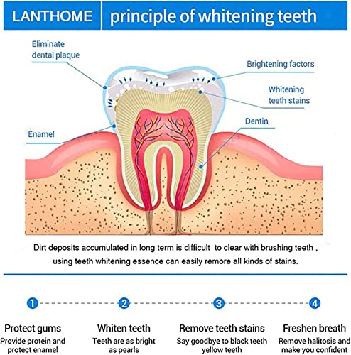 Писалка за Избелване на зъбите, устната кухина, най-Добрите Средства За Избелване на Зъби, Комплект за избелване на зъбите Използвайте Два пъти На ден, че зъбите са станали значително по-бели В рамките на 1 седмица,